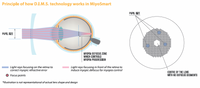 MiYOSMART Myopia Control Lenses Package (6-16 years old)